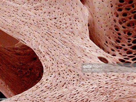 Bone Tissue Coloured Scanning Electron Micrograph Of Cancellous Bone