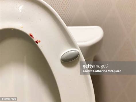 Blood In Toilet Bowl Photos And Premium High Res Pictures Getty Images