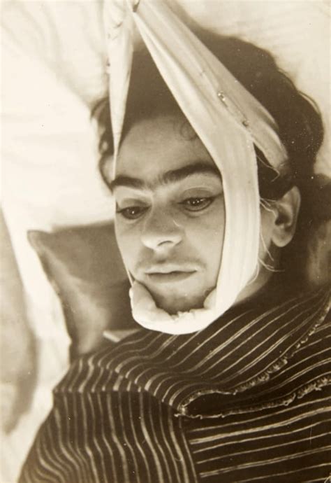 Frida Kahlo As Fue El Accidente De Autob S Que La Hiri Gravemente