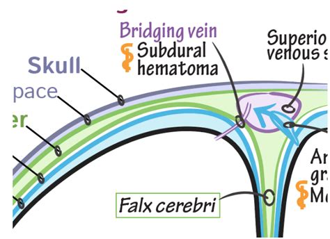 Neuroanatomy Glossary Bridging Vein Draw It To Know It