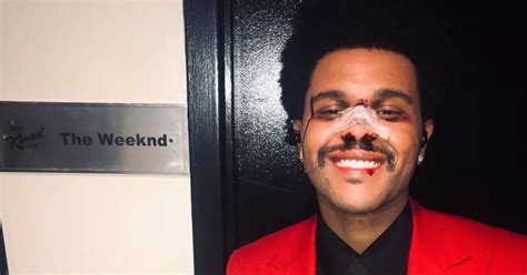 The Weeknd Reconstructive Surgery A Selfie Of The Weeknd In Those Prosthetics Inspired A