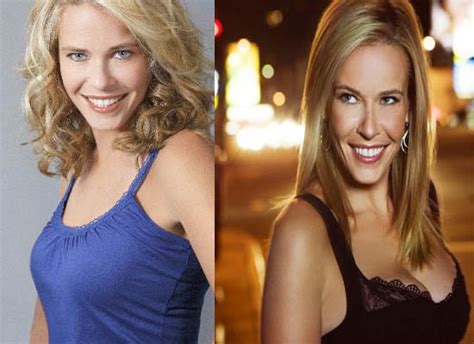 Chelsea Handler Plastic Surgery Before And After Celeb Surgery Com