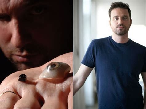 Meet Filmmaker Who Replaced His Eyeball With A Camera To Conduct Documentaries Celebrities