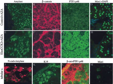 Immunohistochemistry For Acinar Differentiation Markers Of Wild Type