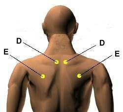 Jerawat di dagu umumnya tidak berbeda dengan jerawat di bagian wajah, leher, dada, atau punggung. Urutan Di Dada, Belakang Badan Dan Tapak Tangan Boleh ...