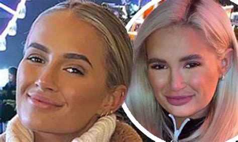 Molly Mae Hague Shares Photos Taken Two Years Apart After Dissolving Her Fillers