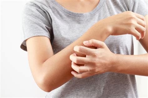 Health Problems Woman Has Itchy Hands Stock Photo Image Of Disease