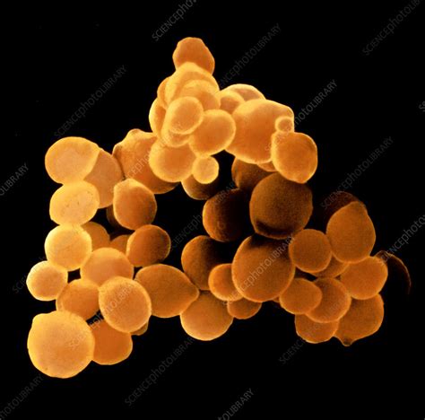 Sem Of Candida Albicans Fungus Stock Image B2500831 Science