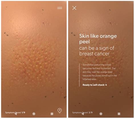 20 Cancer Breast Looks Like Background Usefull For Everyone