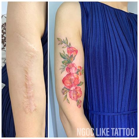 Scar Cover Up Tattoos Help Women Regain Confidence In Their Bodies