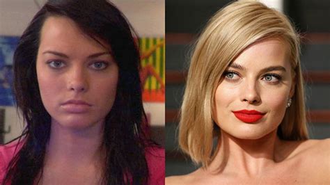 5 Most Shocking Celebrity Plastic Surgery Transformations Before And