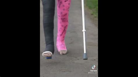 Double Long Leg Cast In Crutches Gossipwebs Castfetish