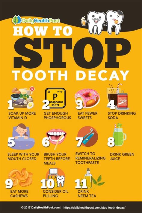 How To Stop Tooth Decay With These 11 Tooth Healthy Habits Dailyhealthpost Tooth Extraction