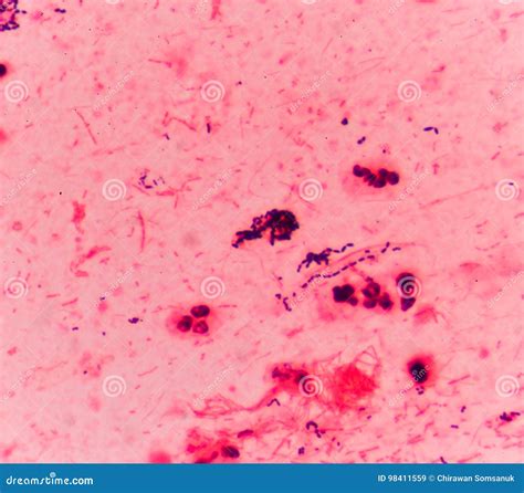 Bacteria Cells Gram Positive Cocci In Chain Stock Image Image Of
