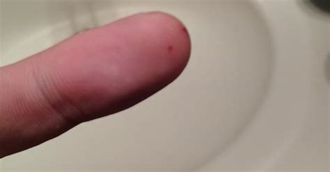 Guitar String Went Through My Finger Album On Imgur