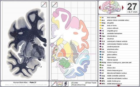 The Human Brain · Atlas Of The Human Brain · Sections · Virtual Microscopy