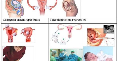 Guru Berbagi Rpp Materi Organ Reproduksi Pada Laki Laki My Xxx Hot Girl