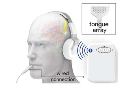 Non Invasive Stimulation Device To Treat Tinnitus Shows Positive Results In Clinical Trials