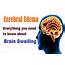 Cerebral Edema Brain Swelling  Types Symptoms Causes And Treatment