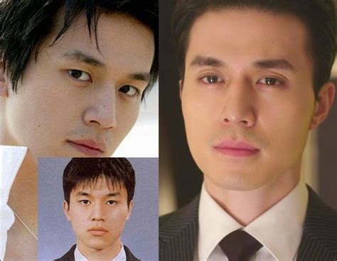 The desire for a thin nose with narrow nostrils has been driving many celebrities to go for a nose job. Lee Dong Wook plastic surgery before and after pictures ...