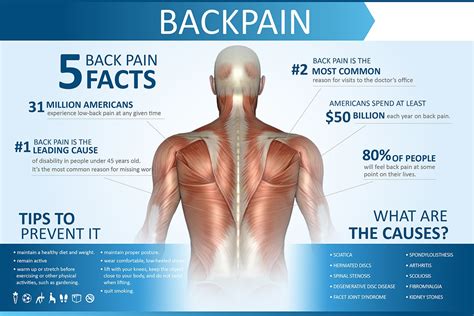 Azist Infographics Portfolio Back Pain