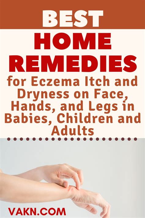 It is good for both. Best Home Remedies For Eczema Itch & Dryness On Face ...