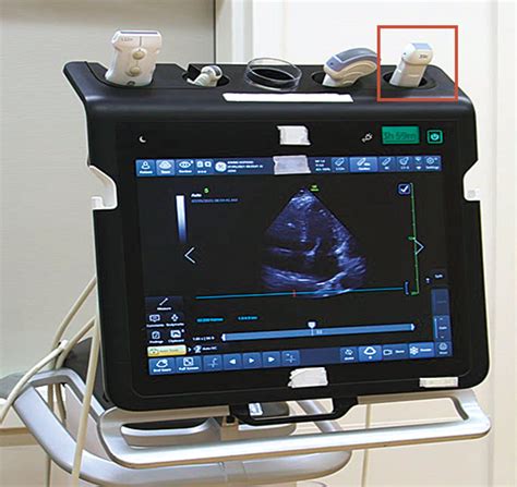 Focused Cardiac Ultrasonography For Right Ventricular Size And Systolic