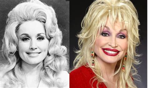 Dollypartonplasticsurgery Celebrities Before And After