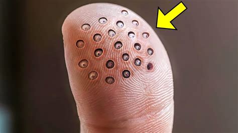 these weird spots suddenly appeared on his finger when the doctors saw it they called the