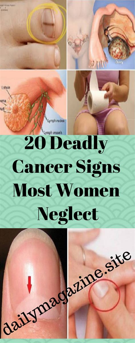 20 Deadly Cancer Signs Most Women Neglect With Images Cancer Sign