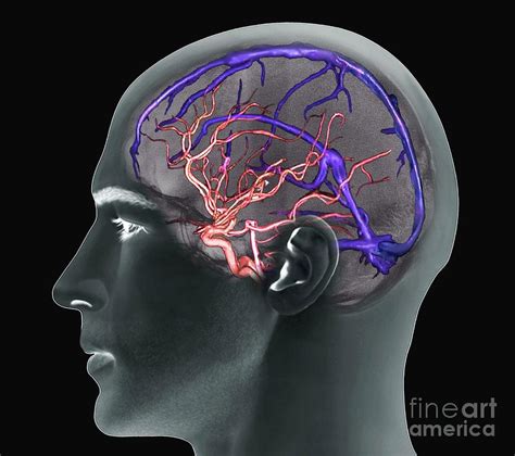 Brain Arteries And Venous Sinuses Photograph By Zephyrscience Photo