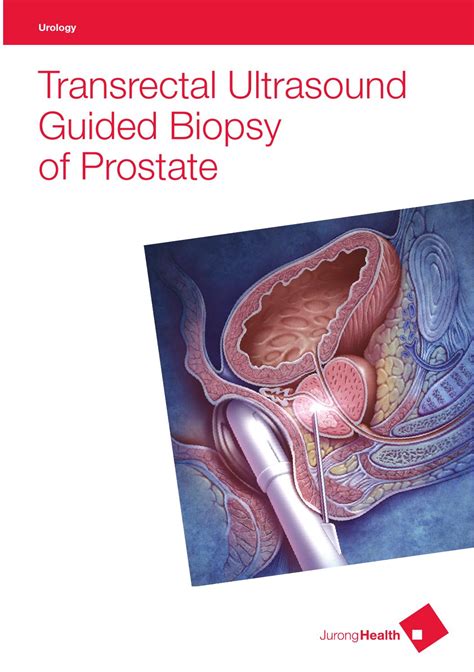 Transrectal Ultrasound Guided Biopsy Of Prostate By Juronghealth Campus