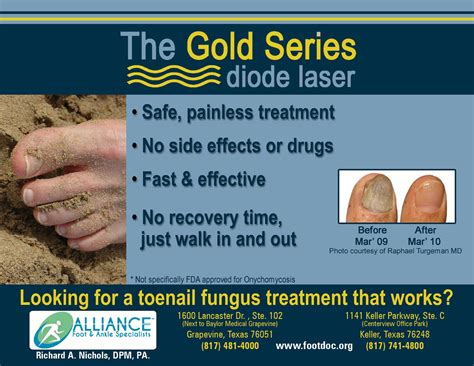 Grapevine And Keller Tx Podiatrists Toenail Fungus Specialists Alliance