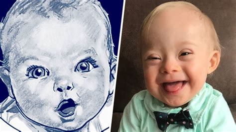 Meet Lucas The 1st Gerber Baby With Down Syndrome