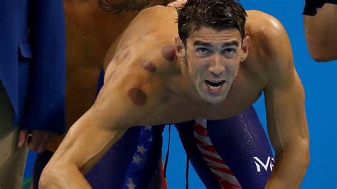 Why Are So Many Olympians Covered In Large Red Circles Bbc News