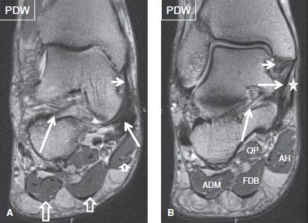 Learn more details about them at kenhub! The Ankle | Musculoskeletal Key