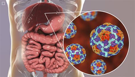 Hepatitis Viral Qué Es Síntomas Y Tratamiento Top Doctors