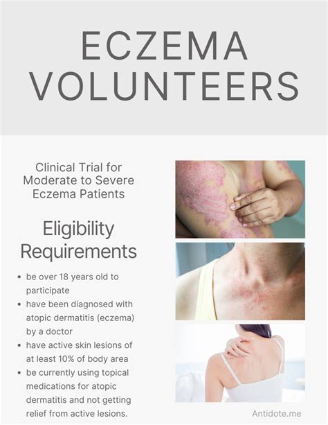 Eczema Clinical Trial Clinical Trials Atopic Dermatitis Severe Eczema