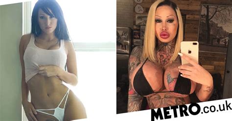 Dancer Addicted To Plastic Surgery Spends £85k On It Metro News