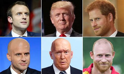 People Still Judge Bald Men As Less Handsome And Successful Daily Mail