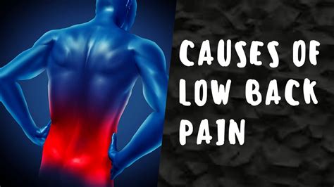 Why Lower Back Pain Causes Of Low Back Pain Youtube