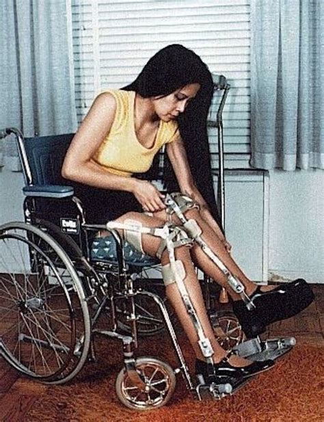 Pin By John Beeson On Leg Braces In 2021 Leg Braces Disabled Women Braces