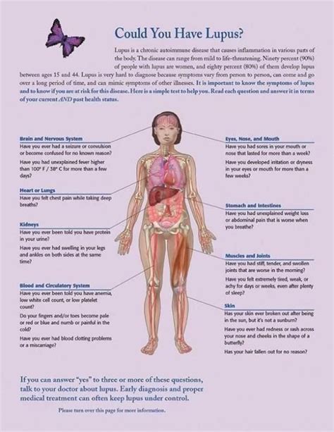 Lupus Symptoms Lupus Facts Lupus Diagnosis Diagnosing Lupus