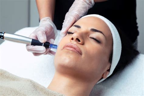 What Is A Vampire Facial What You Need To Know About Microneedling