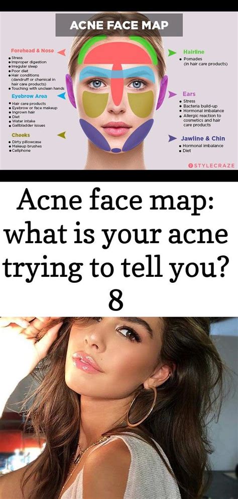 Acne Face Map What Does Acne Reveal About Your Health Face Mapping Face