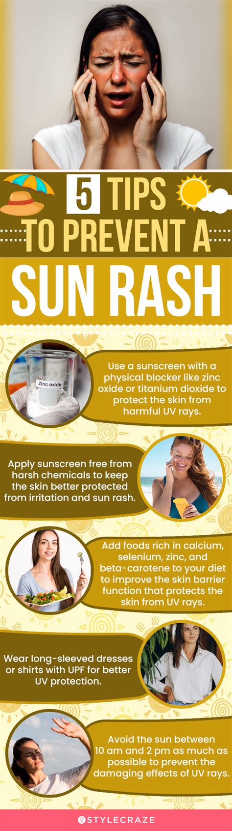 Sun Rash On Skin Causes Symptoms And How To Treat It