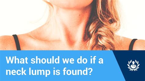 What Should We Do If A Neck Lump Is Found Youtube