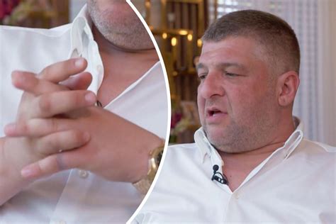 Wegen Burnout: „Goodbye Deutschland“-Star fielen alle Fingernägel aus