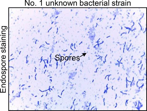 Bacillus Subtilis Gram Stain