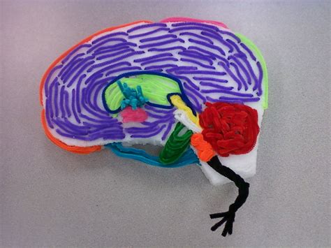 Brain Project Wernickes Area Reticular